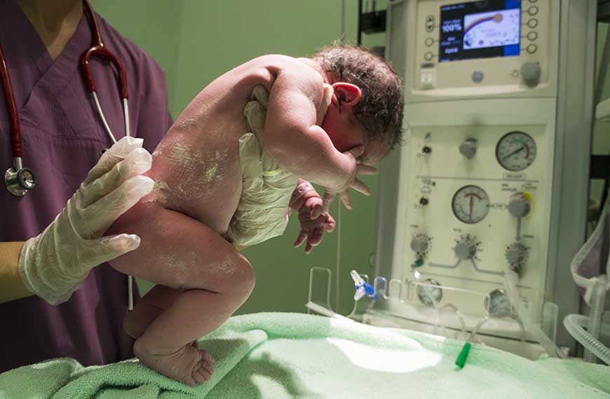 תינוק שנולד הרגע מטופל על ידי הרופא