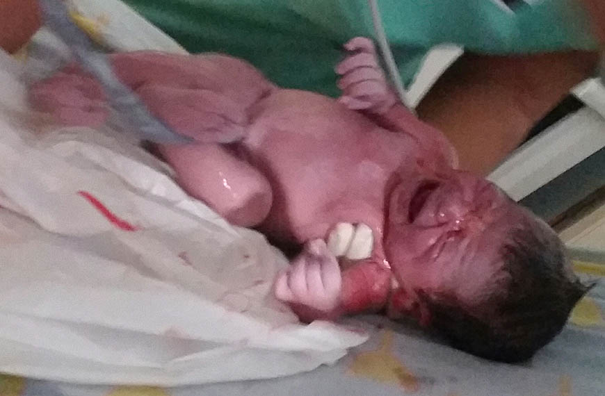 תינוקת ברגע הלידה